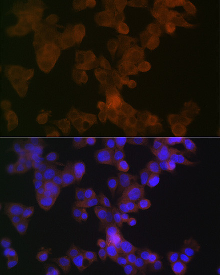 Apolipoprotein L1 Antibody in Immunocytochemistry (ICC/IF)