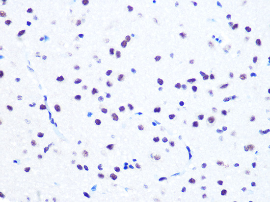 NuMA Antibody in Immunohistochemistry (Paraffin) (IHC (P))