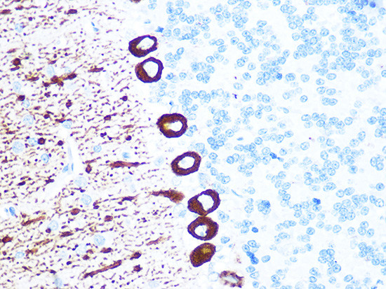 IP3 Receptor 1 Antibody in Immunohistochemistry (Paraffin) (IHC (P))