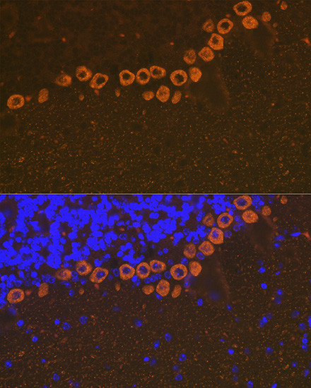 IP3 Receptor 1 Antibody in Immunohistochemistry (Paraffin) (IHC (P))