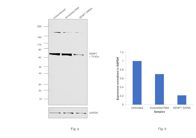 SENP1 Antibody in Western Blot (WB)