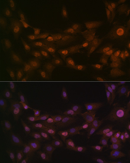 PRMT1 Antibody in Immunocytochemistry (ICC/IF)