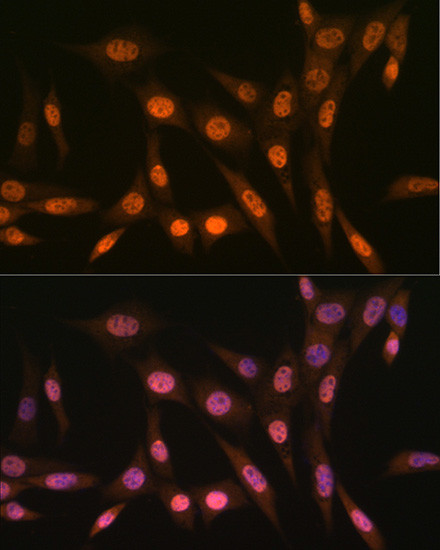 PRMT1 Antibody in Immunocytochemistry (ICC/IF)