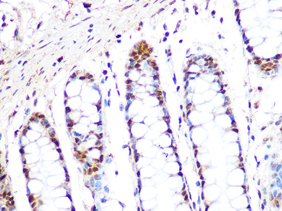 PRMT1 Antibody in Immunohistochemistry (Paraffin) (IHC (P))