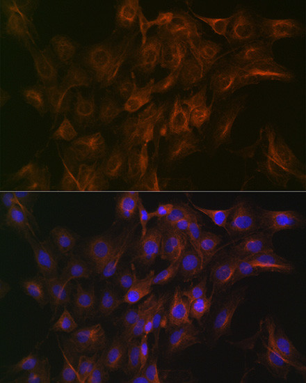 Arp3 Antibody in Immunocytochemistry (ICC/IF)