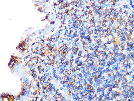 Arp3 Antibody in Immunohistochemistry (Paraffin) (IHC (P))