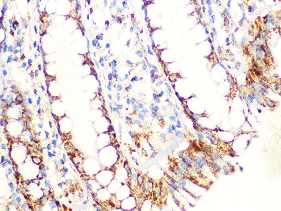 Aconitase 2 Antibody in Immunohistochemistry (Paraffin) (IHC (P))