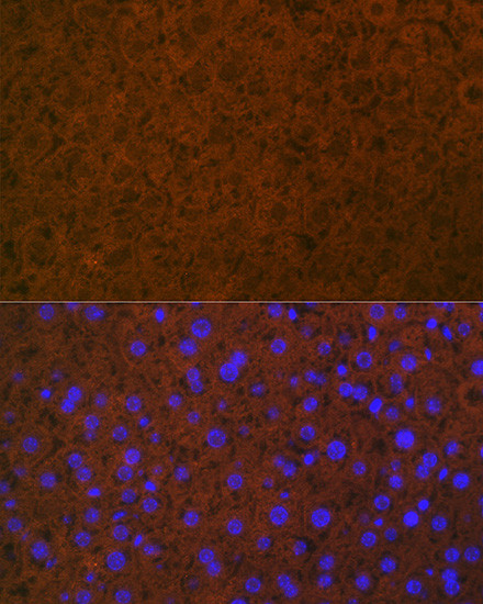 Protein C Antibody in Immunohistochemistry (Paraffin) (IHC (P))