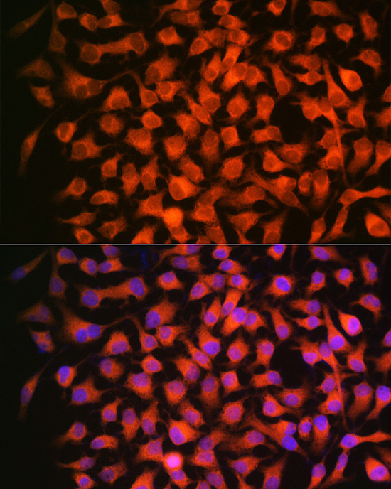 RARB Antibody in Immunocytochemistry (ICC/IF)