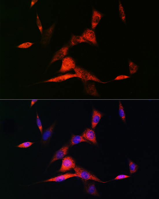 RARB Antibody in Immunocytochemistry (ICC/IF)