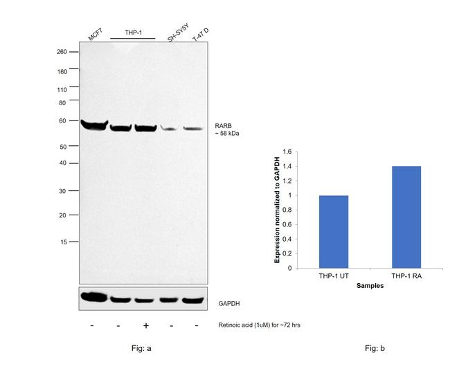 RARB Antibody in Western Blot (WB)