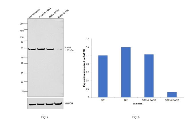 RARB Antibody in Western Blot (WB)