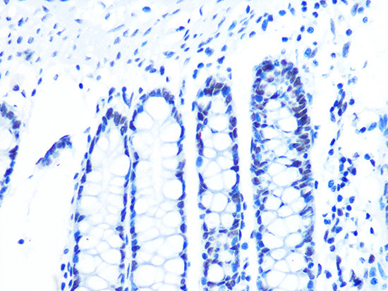 U2AF2 Antibody in Immunohistochemistry (Paraffin) (IHC (P))