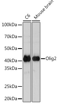 OLIG2 Antibody in Western Blot (WB)