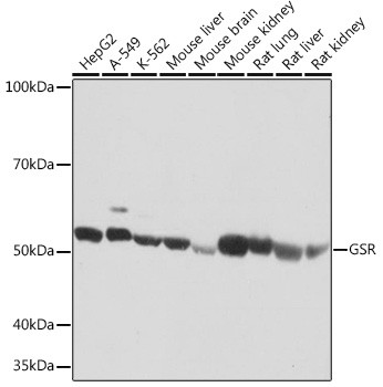 GSR Antibody in Western Blot (WB)