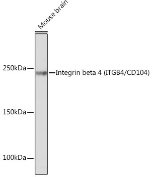 CD104 Antibody in Western Blot (WB)