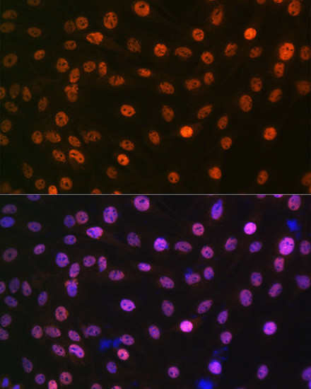 MAD2L2 Antibody in Immunocytochemistry (ICC/IF)