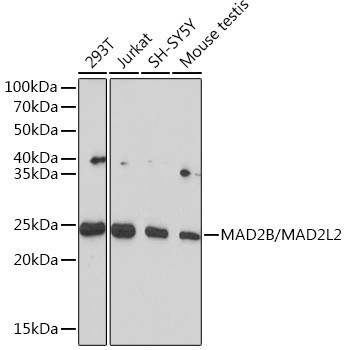 MAD2L2 Antibody in Western Blot (WB)