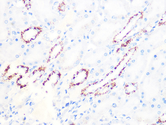 PDHB Antibody in Immunohistochemistry (Paraffin) (IHC (P))