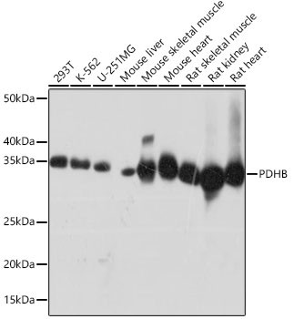 PDHB Antibody in Western Blot (WB)