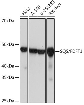 FDFT1 Antibody in Western Blot (WB)