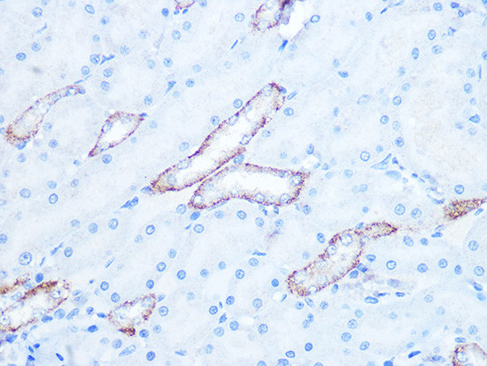 IRAK2 Antibody in Immunohistochemistry (Paraffin) (IHC (P))