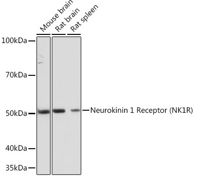 TACR1 Antibody in Western Blot (WB)