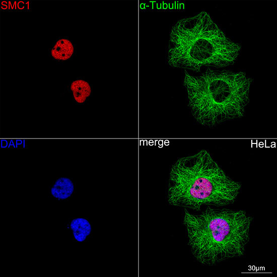 SMC1 Antibody in Immunocytochemistry (ICC/IF)