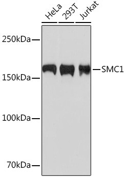 SMC1 Antibody in Western Blot (WB)