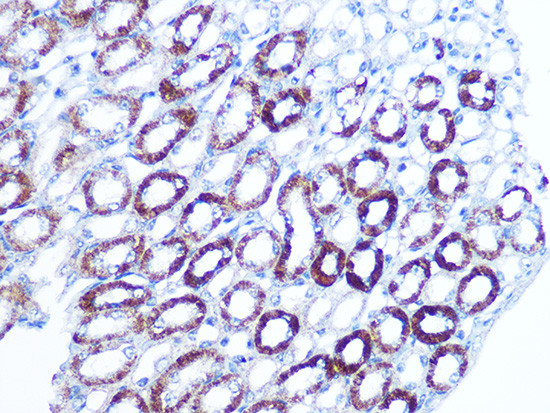 BAG3 Antibody in Immunohistochemistry (Paraffin) (IHC (P))