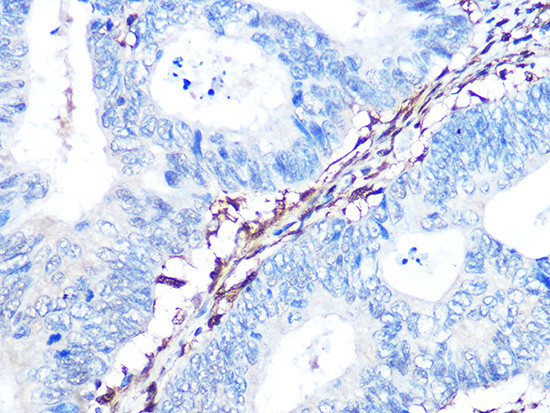 Galectin 1 Antibody in Immunohistochemistry (Paraffin) (IHC (P))