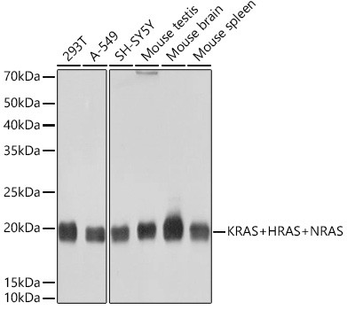 Pan Ras Antibody in Western Blot (WB)