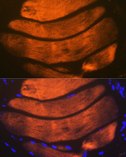 TNNI2 Antibody in Immunocytochemistry (ICC/IF)