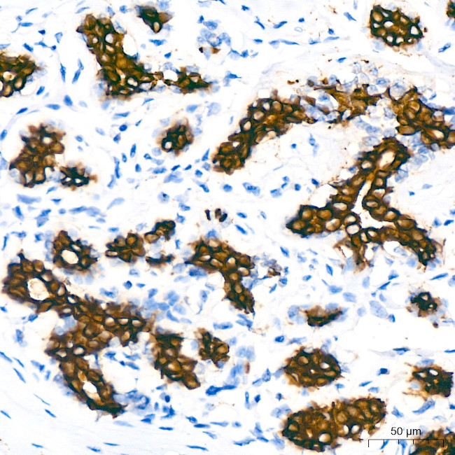 Cytokeratin 7 Antibody in Immunohistochemistry (Paraffin) (IHC (P))