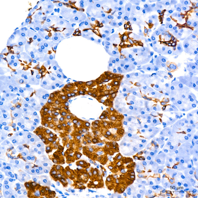 Cytokeratin 7 Antibody in Immunohistochemistry (Paraffin) (IHC (P))