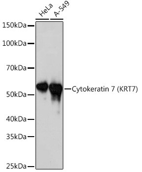 Cytokeratin 7 Antibody in Western Blot (WB)