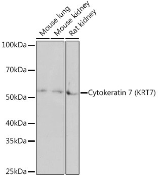 Cytokeratin 7 Antibody in Western Blot (WB)