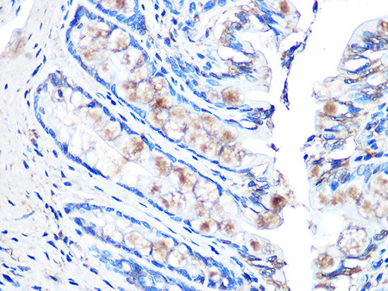 MUC2 Antibody in Immunohistochemistry (Paraffin) (IHC (P))