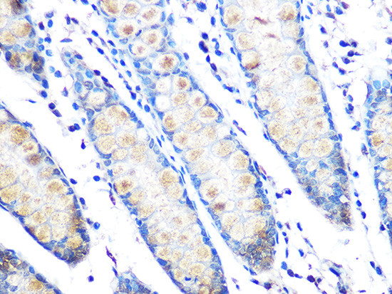 MUC2 Antibody in Immunohistochemistry (Paraffin) (IHC (P))