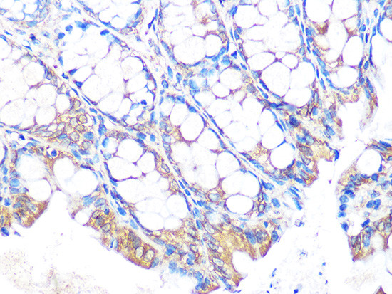 MUC2 Antibody in Immunohistochemistry (Paraffin) (IHC (P))