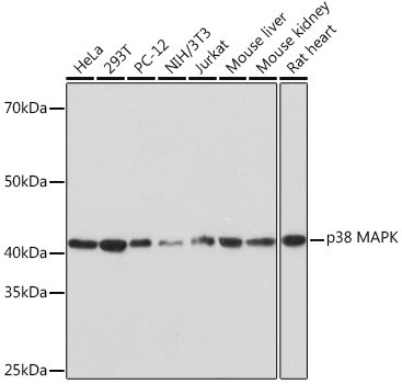 p38 MAPK Antibody in Western Blot (WB)