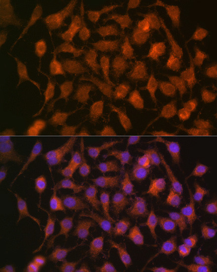 HSP70 Antibody in Immunocytochemistry (ICC/IF)