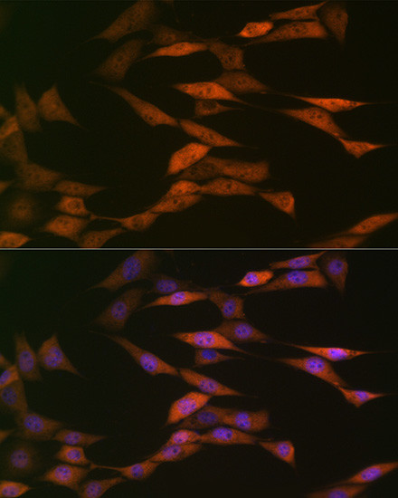 HSP70 Antibody in Immunocytochemistry (ICC/IF)