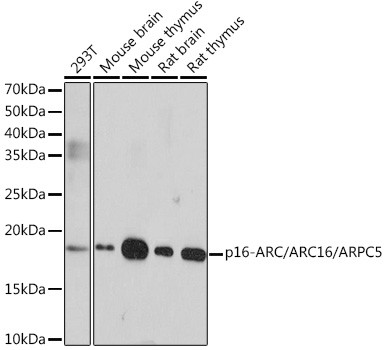 ARPC5 Antibody in Western Blot (WB)