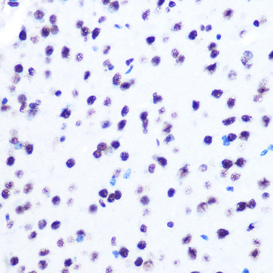 Hydroxyl-Histone H2A (Tyr39) Antibody in Immunohistochemistry (Paraffin) (IHC (P))