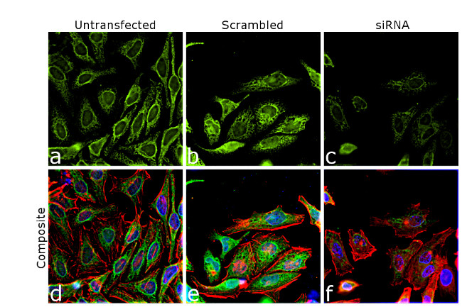 Calnexin Antibody in Immunocytochemistry (ICC/IF)