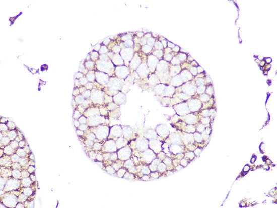 RhoA/RhoB/RhoC Antibody in Immunohistochemistry (Paraffin) (IHC (P))