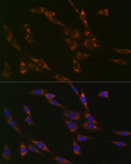 RPS3 Antibody in Immunocytochemistry (ICC/IF)