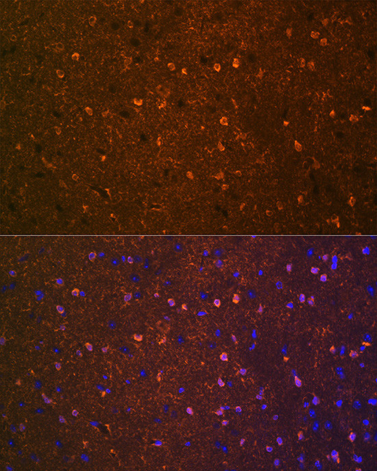 BDNF Antibody in Immunohistochemistry (Paraffin) (IHC (P))