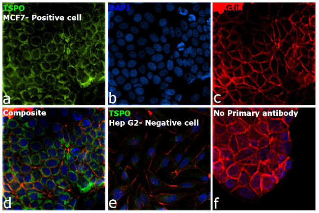 TSPO Antibody in Immunocytochemistry (ICC/IF)